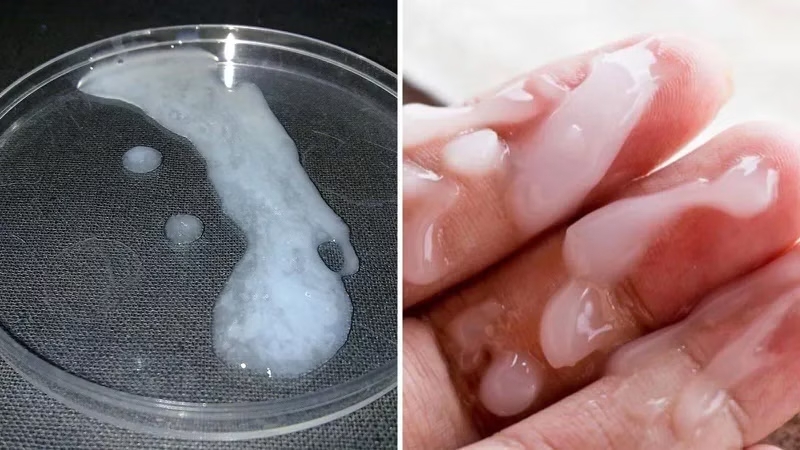 Một số nguyên nhân từ môi trường sống và lối sống độc hại khiến tinh trùng bất thường